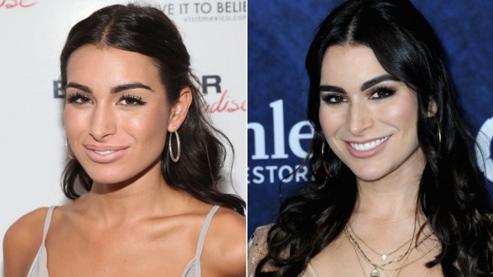 Ashley Iaconetti cosmetic ehancements before and after