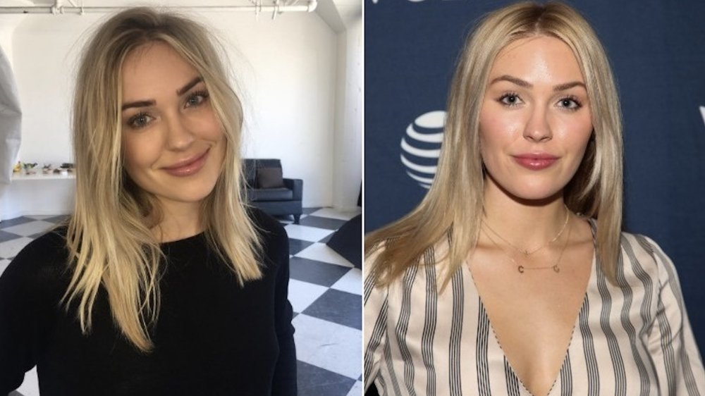 Cassie Randolph cosmetic ehancements before and after