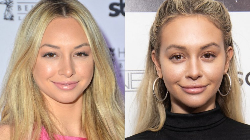 Corinne Olympios cosmetic ehancements before and after