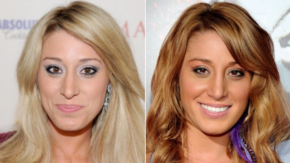 Vienna Girardi plastic surgery before and after