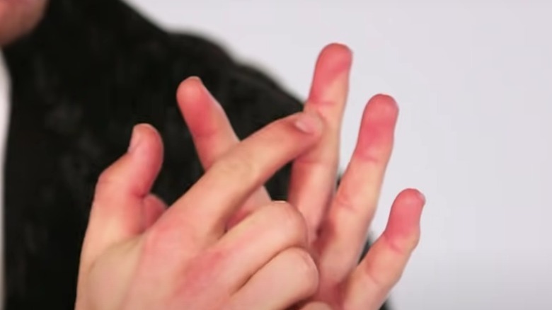 Nick Jonas' hands pointing out scar