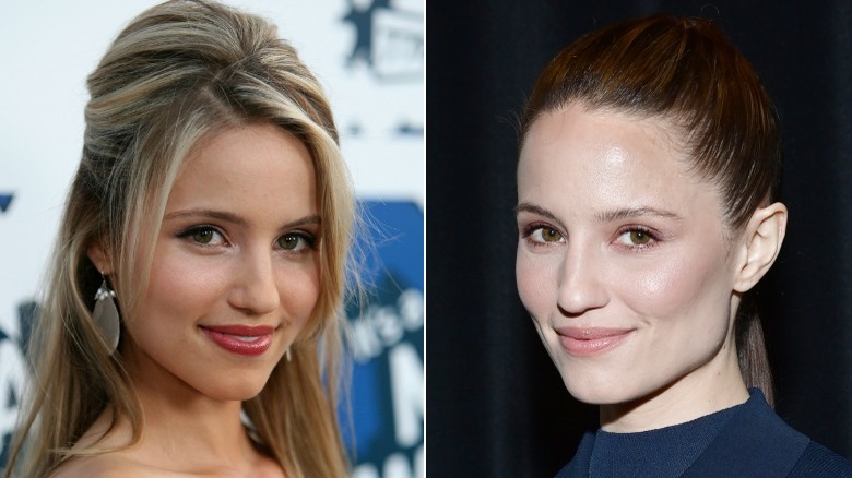 Side-by-side pictures of Dianna Agron smiling before and after her nose job