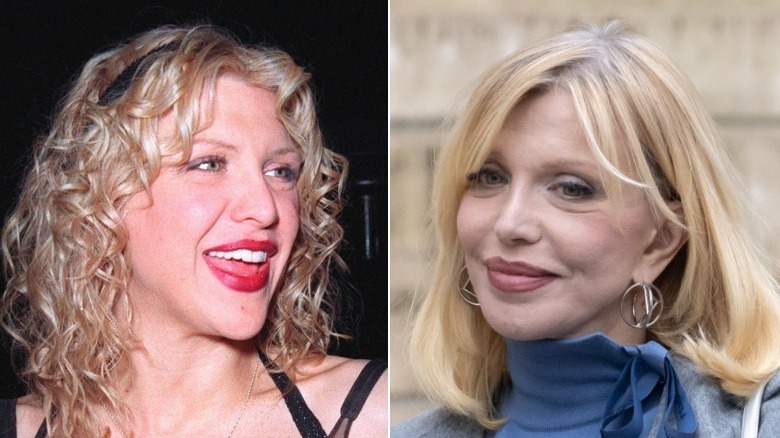 Side-by-side pictures of Courtney Love smiling before and after her nose job