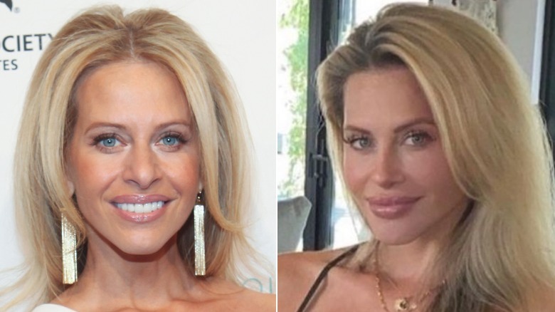 Side-by-side pictures of Dina Manzo smiling before and after her nose job