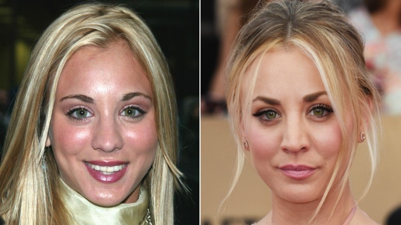 Side-by-side pictures of Kaley Cuoco smiling before and after her nose job