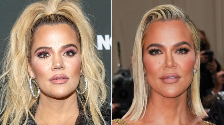 Side-by-side pictures of Khloe Kardashian posing before and after her nose job