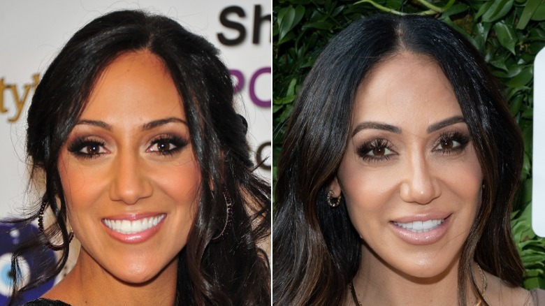 Side-by-side pictures of Melissa Gorga smiling before and after her nose job