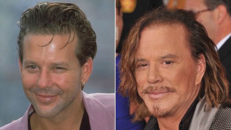 Side-by-side pictures of Mickey Rourke smiling before and after his nose job