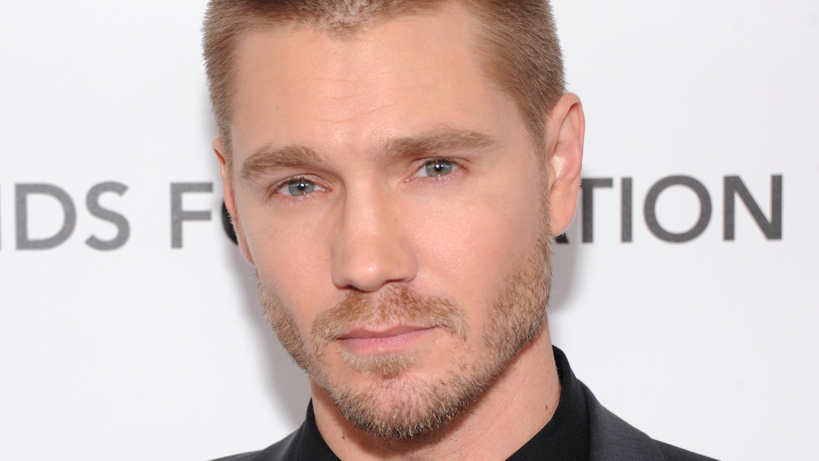 Chad Michael Murray Before And After Nose Job