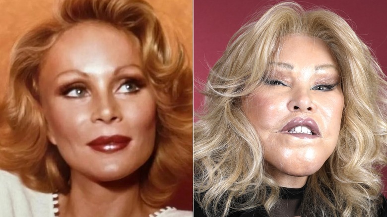 Jocelyn Wildenstein before plastic surgery and posing for a portrait in 2024