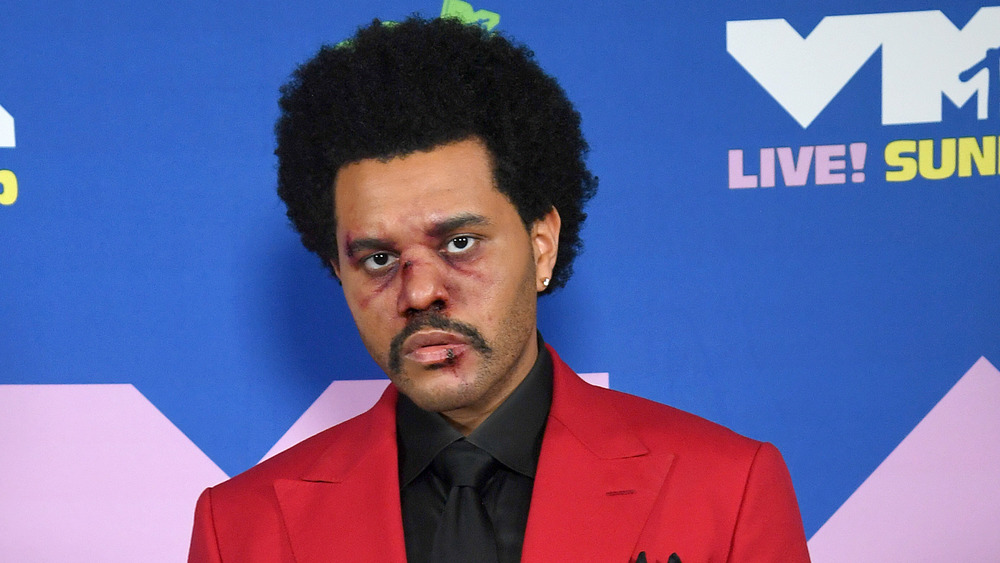 The Weeknd with bruises on face on red carpet