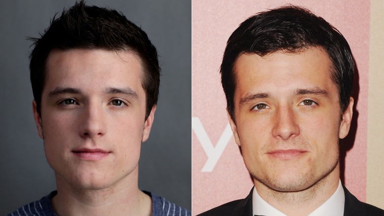 Josh Hutcherson before and after surgery