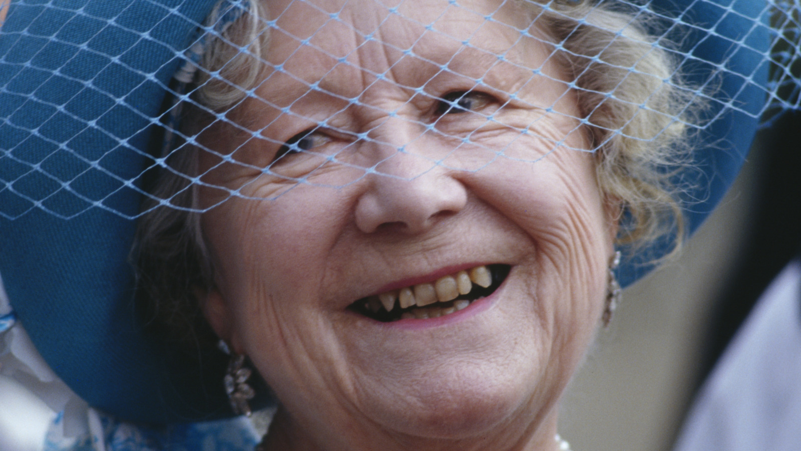The Real Reason This Royals Teeth Were So Bad According To A Dentist 