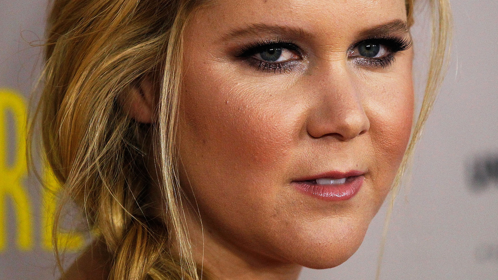 The Scary Surfing Accident That Left Amy Schumer With 41 Stitches