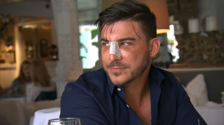 Jax Taylor with a bandage on his nose