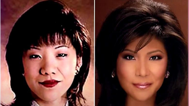 Julie Chen before and after surgery