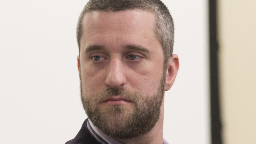 Dustin Diamond looking serious 