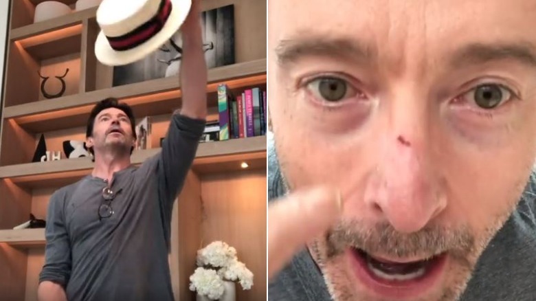 Hugh Jackman nose hat Instagram 