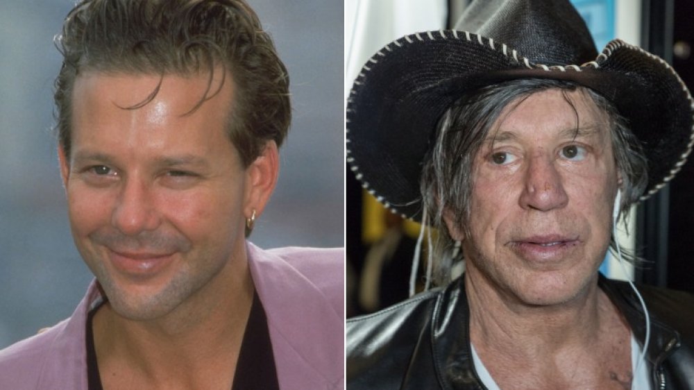 The Truth About Mickey Rourke S Plastic Surgery