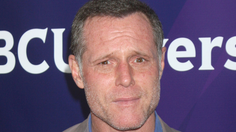 Jason Beghe furrowing brow