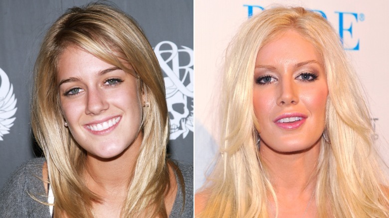 Split image of Heidi Montag smiling