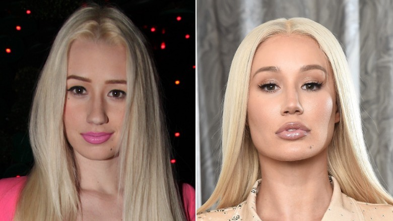 Split image of Iggy Azalea posing for pictures