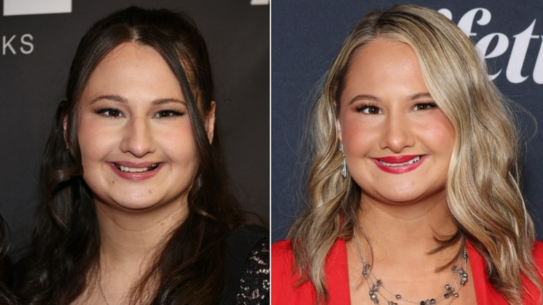 Gypsy Rose Blanchard's nose job transformation