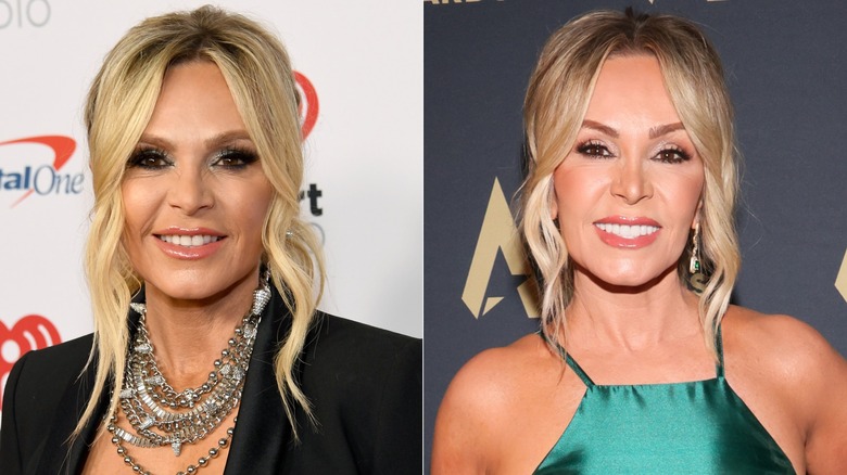 Tamra Judge's brow lift transformation