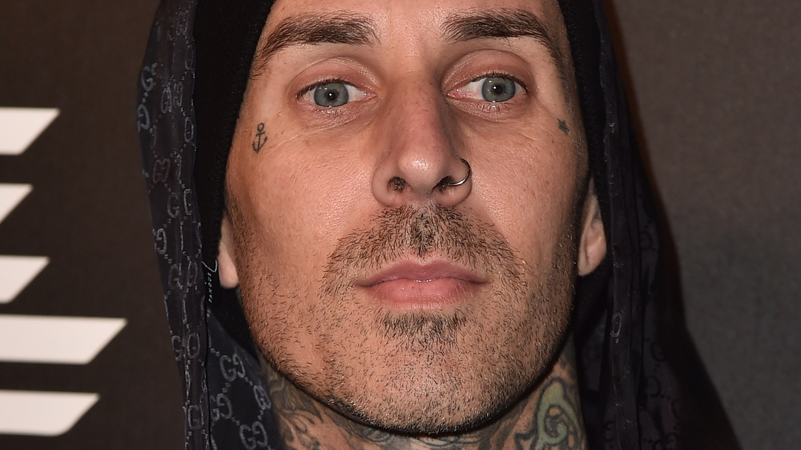 Travis Barker's Health Reportedly Moves In The Right Direction After 