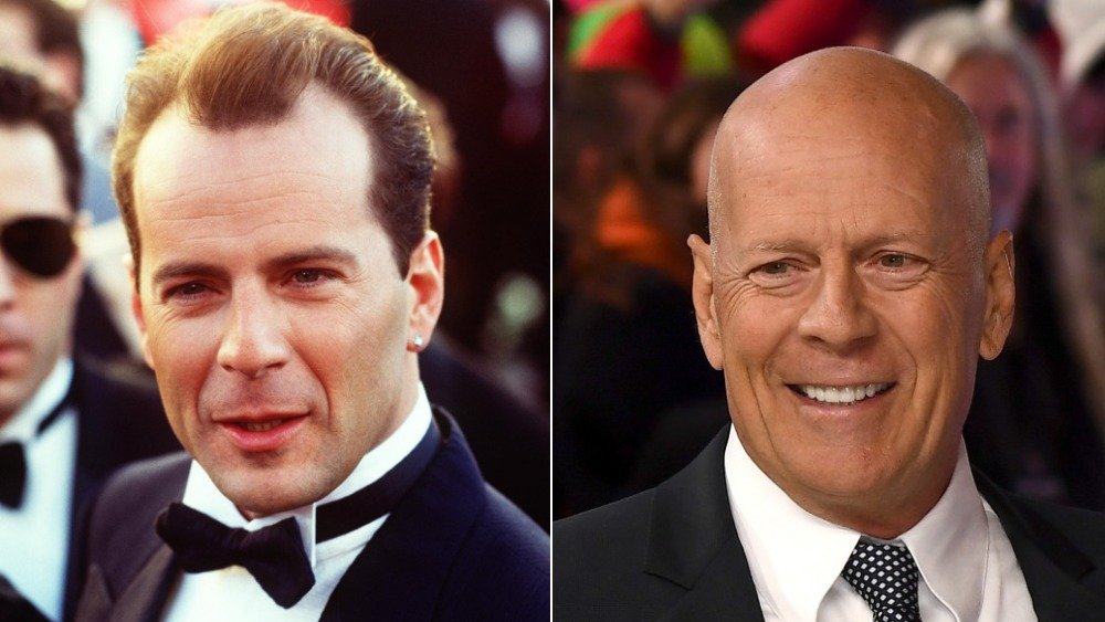 Bruce Willis in a tux on the left with hair, bald on the right