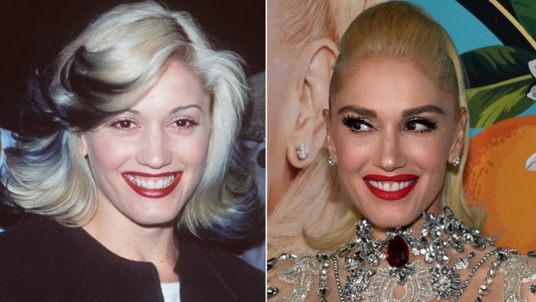 Gwen Stefani before and after plastic surgery