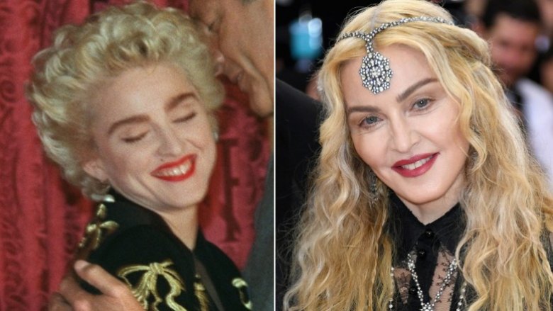 Madonna before and after plastic surgery