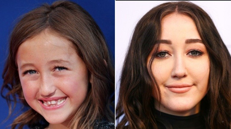 Noah Cyrus before and after alleged plastic surgery