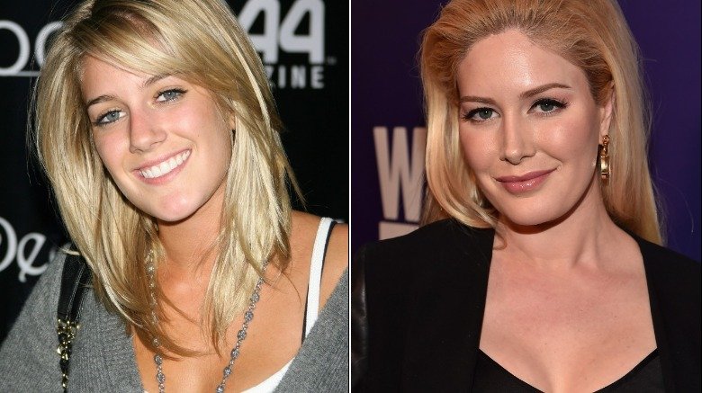 What These Reality Stars Looked Like Before And After Plastic Surgery