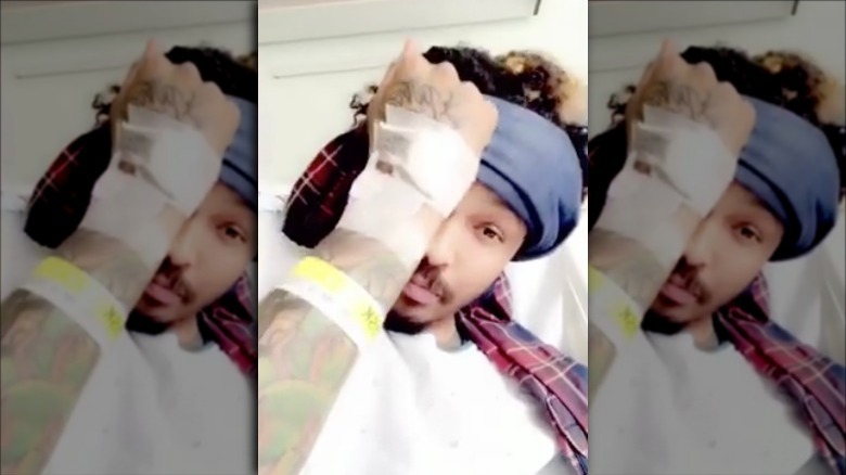 August Alsina showing bandaged hand.