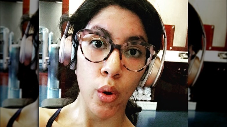 Stephanie Beatriz with acne