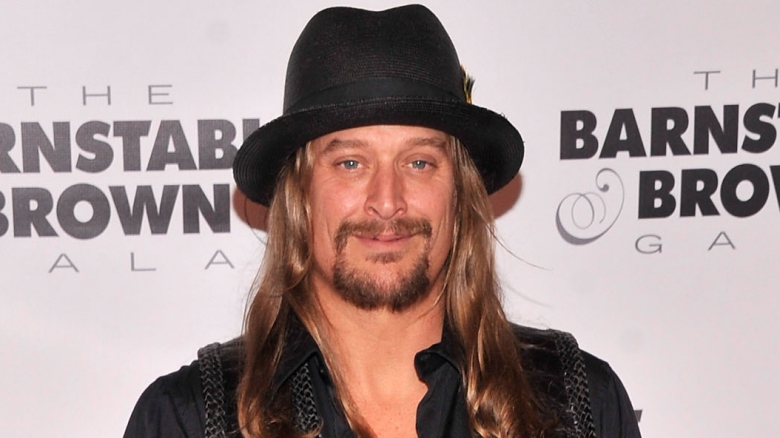 Why We Can Stop Hating Kid Rock